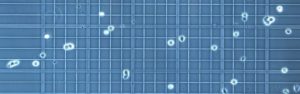 hemocytometer calculation